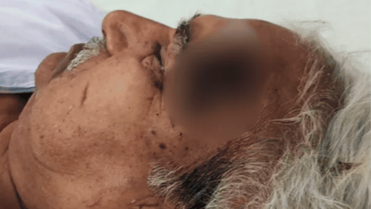 सुबह टहलते समय हुआ हमला, दस दिन पहले दोनों पक्षों में हुई थी कहासुनी 