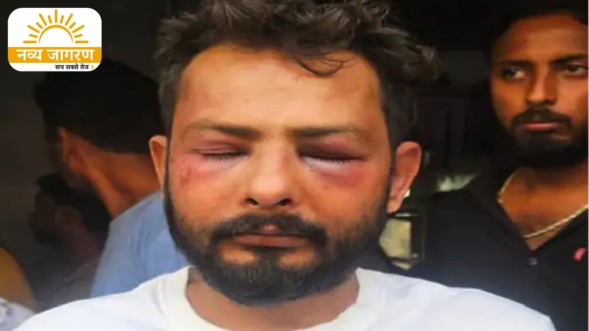 रॉड से पीटकर किया लहूलुहान, गैराज से लौटते समय रास्ते में रोका