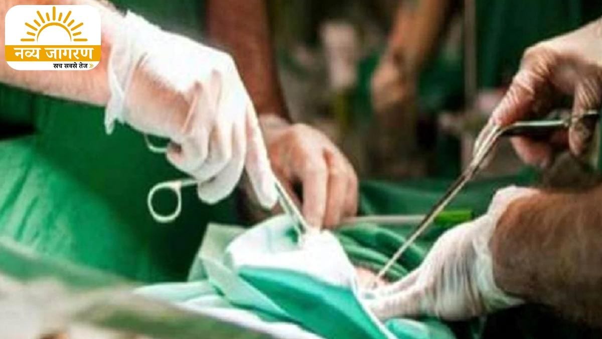 दूसरी सर्जरी कर निकाला गया बाहर, सीएमओ ने जांच कमेटी का किया गठन